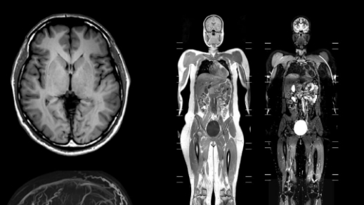 レントゲンイメージ